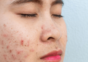25 Reasons to See a Skin Allergy Specialist Near You