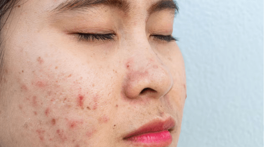 25 Reasons to See a Skin Allergy Specialist Near You