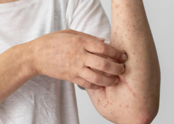 Skin Allergy Cream Name List - Top Solutions for Relief