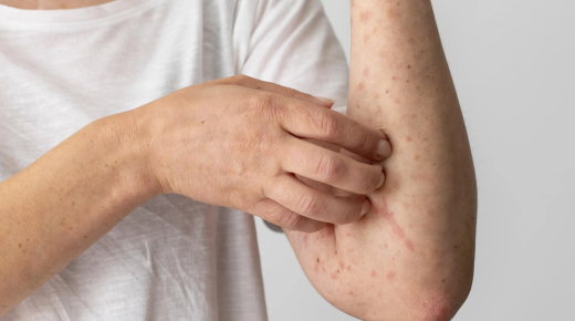Skin Allergy Cream Name List – Top Solutions for Relief