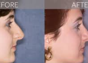 Ponte Vedra Plastic Surgery Nocatee - Your Guide to Cosmetic Enhancements