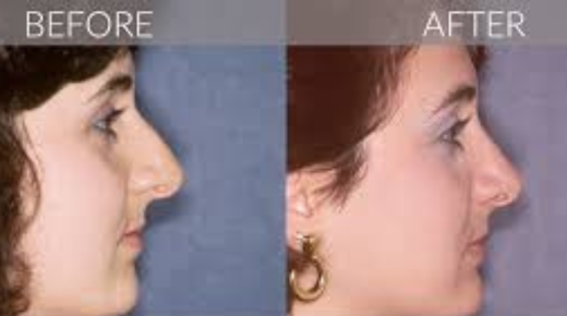 Ponte Vedra Plastic Surgery Nocatee - Your Guide to Cosmetic Enhancements