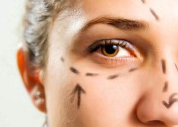 The Journey of Plastic Surgery Scar Removal - Before and After