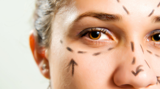 The Journey of Plastic Surgery Scar Removal - Before and After