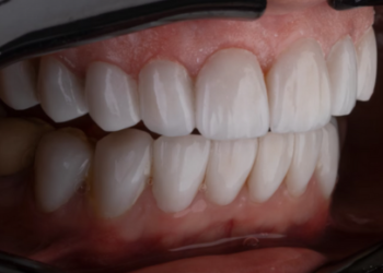 cosmetic dental treatment