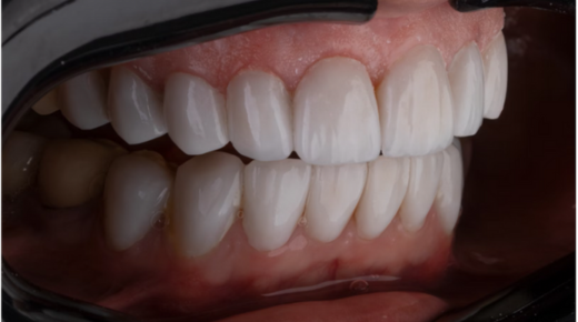 The Latest Cosmetic Dentistry Procedures For a Bright Smile