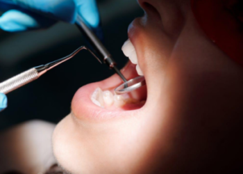 dental implant procedure