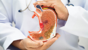 Best Gastroenterology Hospital In Hyderabad